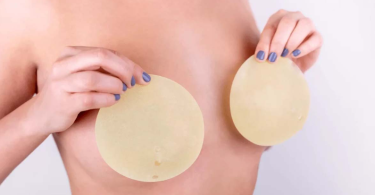 breast implant1 2