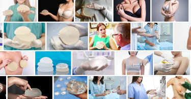 Breast Implants