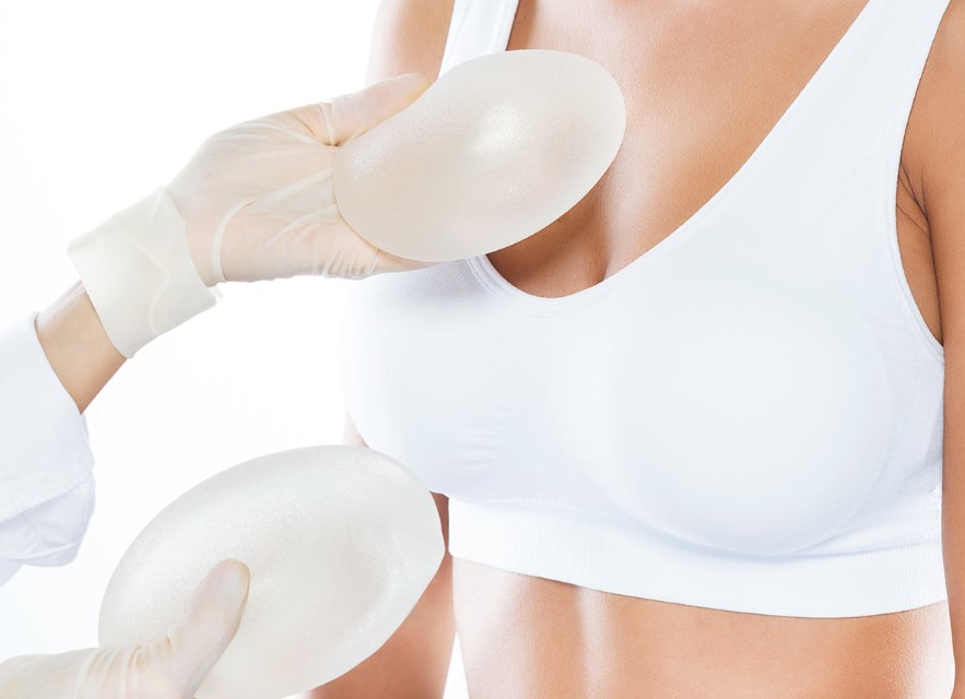 Breast Implants Under the Muscle